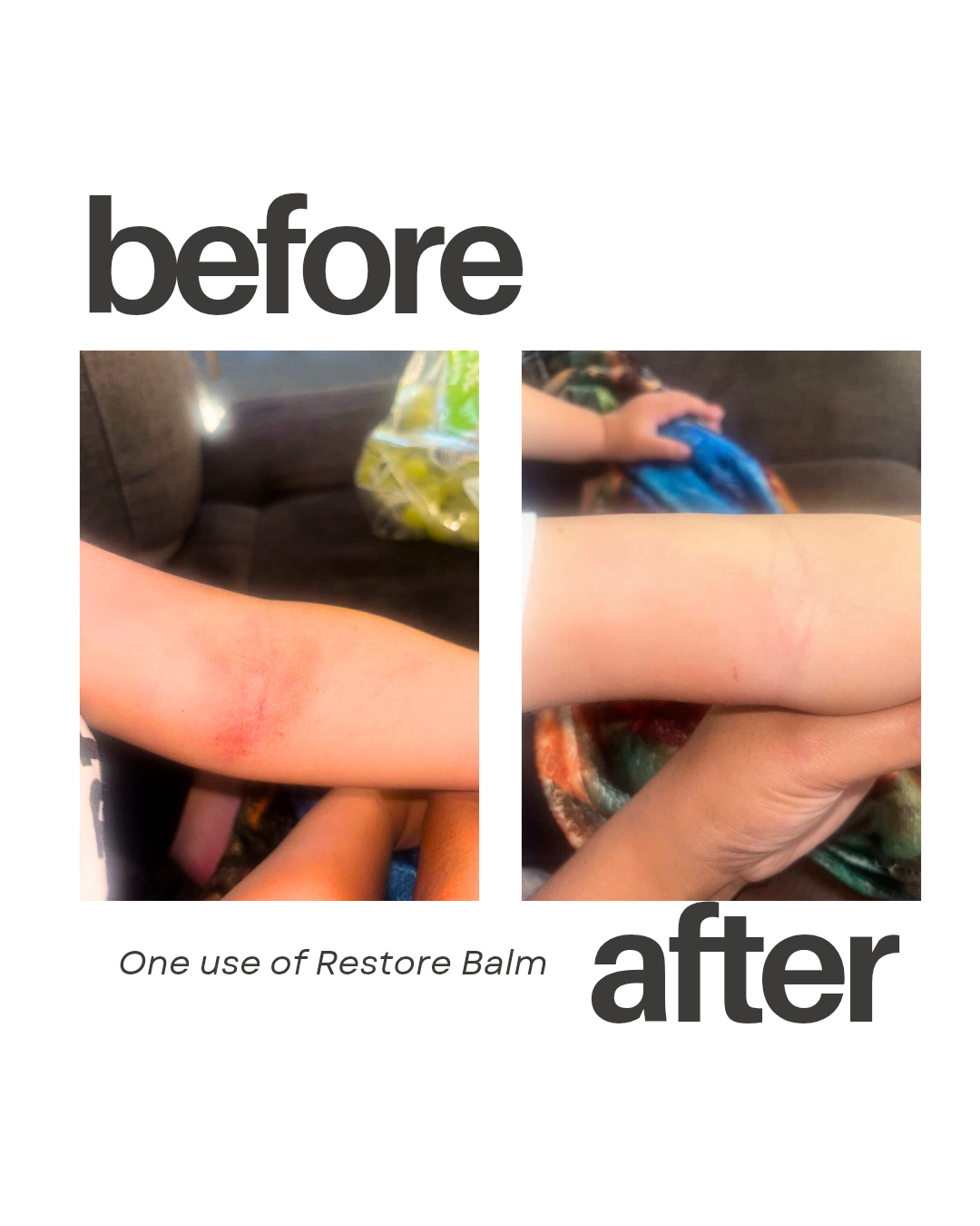 Restore Hemp Oil Balm (Eczema & Psoriasis safe)